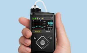 FDA одобрило первую в мире искусственную поджелудочную железу