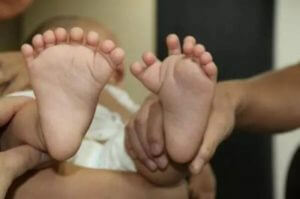 В Китае мать с 24 пальцами родила ребенка с 31 пальцем