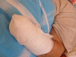 В Мексике шесть воров лишились кисти рук