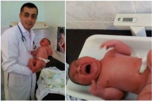 Жительница Азатамут родила ребенка-великана