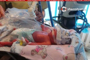 Состояние родившихся в Ереване пятерых близнецов крайне тяжелое - Минздрав