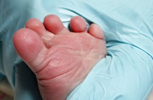 Скончалась еще одна из пяти новорожденных близнецов в Ереване