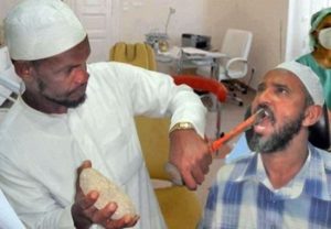 В России стоматолог ради денег вырвал 22 здоровых зуба