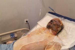 В Баку мужчина поджег себя у банка из-за долгов