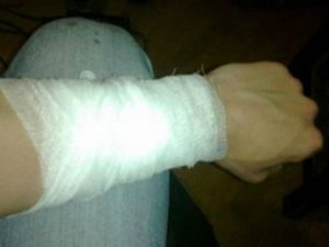 В Баку школьники вскрыли себе вены