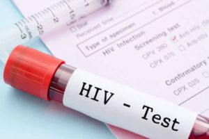 В Азербайджане зарегистрировано более 400 новых случаев инфицирования ВИЧ