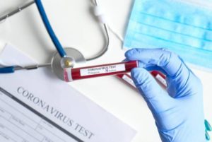 В Армении проведено 120 тестов по выявлению коронавируса, один положительный результат