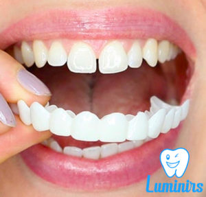 Съёмные люминиры от Luminirs это идеальная улыбка доступная каждому