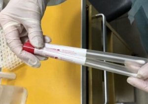 Коронавирус в Армении: за сутки зарегистрировано 115 новых случаев заражения