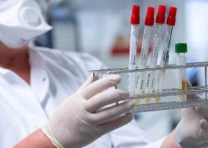 В Армении за сутки зарегистрировано 392 новых случая заражения коронавирусом