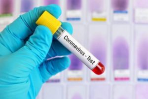 В Армении подтверждено 174 случая COVID-19