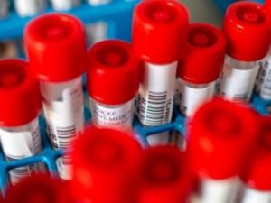 В Армении за сутки зарегистрировано 370 новых случаев заражения коронавирусом