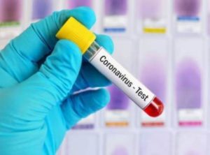 В Армении за сутки зарегистрировано 532 новых случая заражения коронавирусом