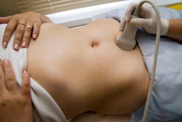 УЗИ малого таза: подготовка