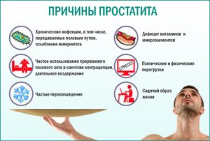 Методы лечения простатита