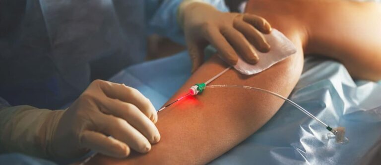 Чем занимается сосудистый хирург?