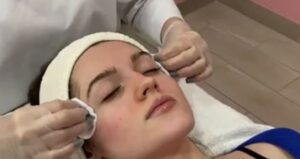 Как убрать пигментацию на лице: современные методы и технологии в косметологии