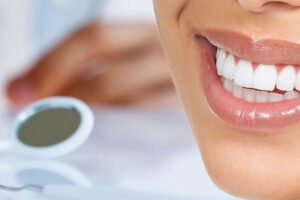 Кабинетное отбеливание зубов: профессиональный подход к улучшению вашей улыбки