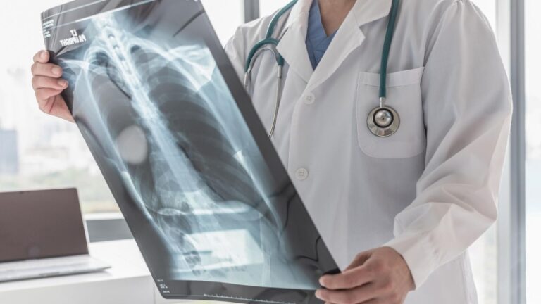 Эксперт рассказал, как предотвратить развитие остеопороза