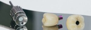 Импланты Dentium: южнокорейское качество и надёжность в стоматологии