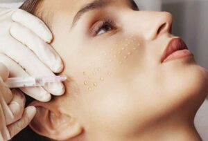 Курс биоревитализации: омоложение и увлажнение кожи с помощью гиалуроновой кислоты