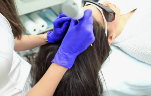 Лазерная терапия для кожи головы и волос: стимулирование роста, устранение проблем и улучшение качества волос